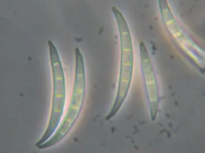 Fusarium spore micrograph taken using Martin Microscope adapter
