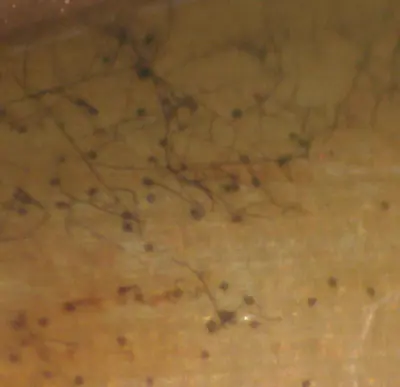 Gaeumannomyces micrograph taken using Martin Microscope adapter