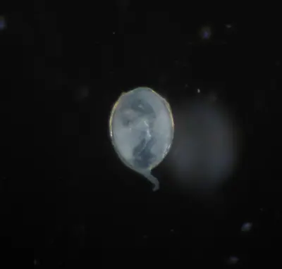 Root knot nematode female