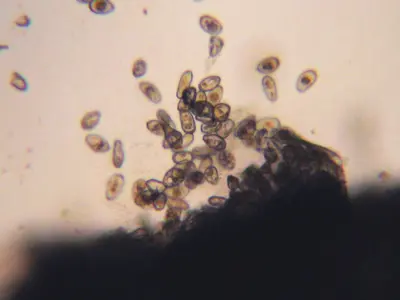 Rust spores