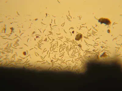 Anthracnose on fine fescue