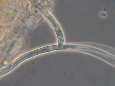 Waitea on poa close up