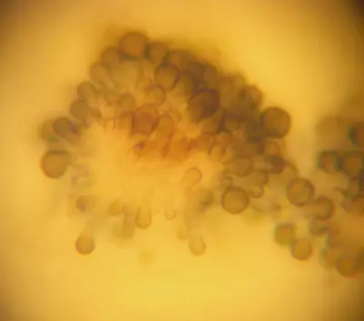 Coniosporium on GN1
