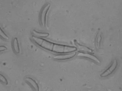 Name that disease 4