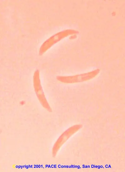 Anthracnose conidia