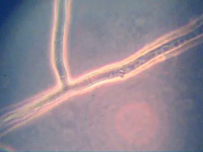 Rhizoctonia hypha