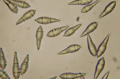 Gray leaf spot