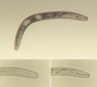 Ring nematode