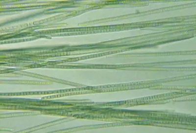 Trichomes of cyanobacteria